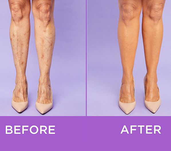 Tarte Dropped A Full-Body Shape Tape Aimed At Stretch Marks & Age Spots