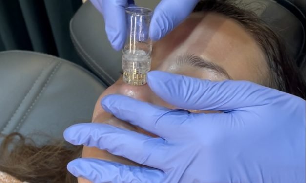 The Best Skin Treatments To Get Before Your Wedding