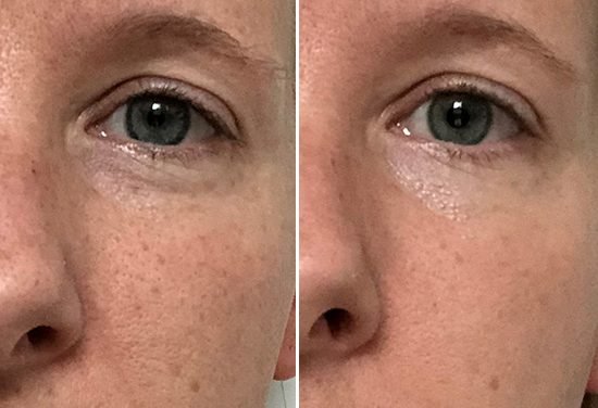 Shoppers Call This 2-Step Face Peel ‘Magical’ Thanks to Its Wrinkle-Erasing Capabilities & It Works in Minutes