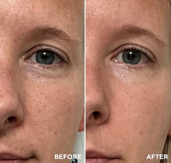 Shoppers Call This 2-Step Face Peel ‘Magical’ Thanks to Its Wrinkle-Erasing Capabilities & It Works in Minutes