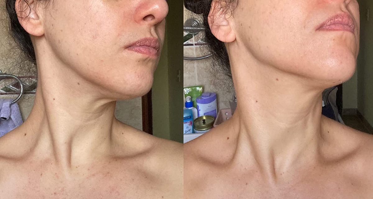 This $12 Firming Neck Cream Has the Most Legendary Before & After Photos From Reviewers