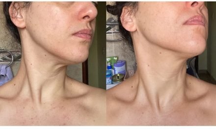 This $12 Firming Neck Cream Has the Most Legendary Before & After Photos From Reviewers